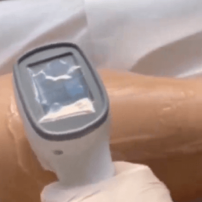 laser-dioda-targoviste