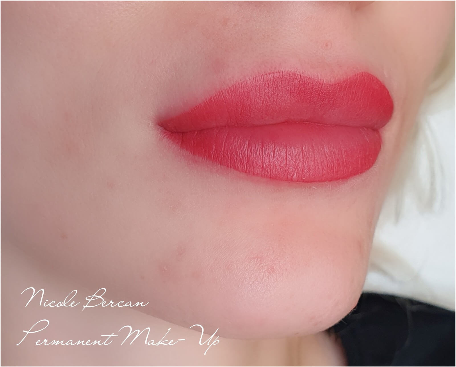 micropimentare-buze-1